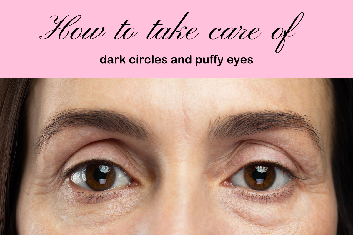 How to take care of dark circles and puffy eyes blog cover